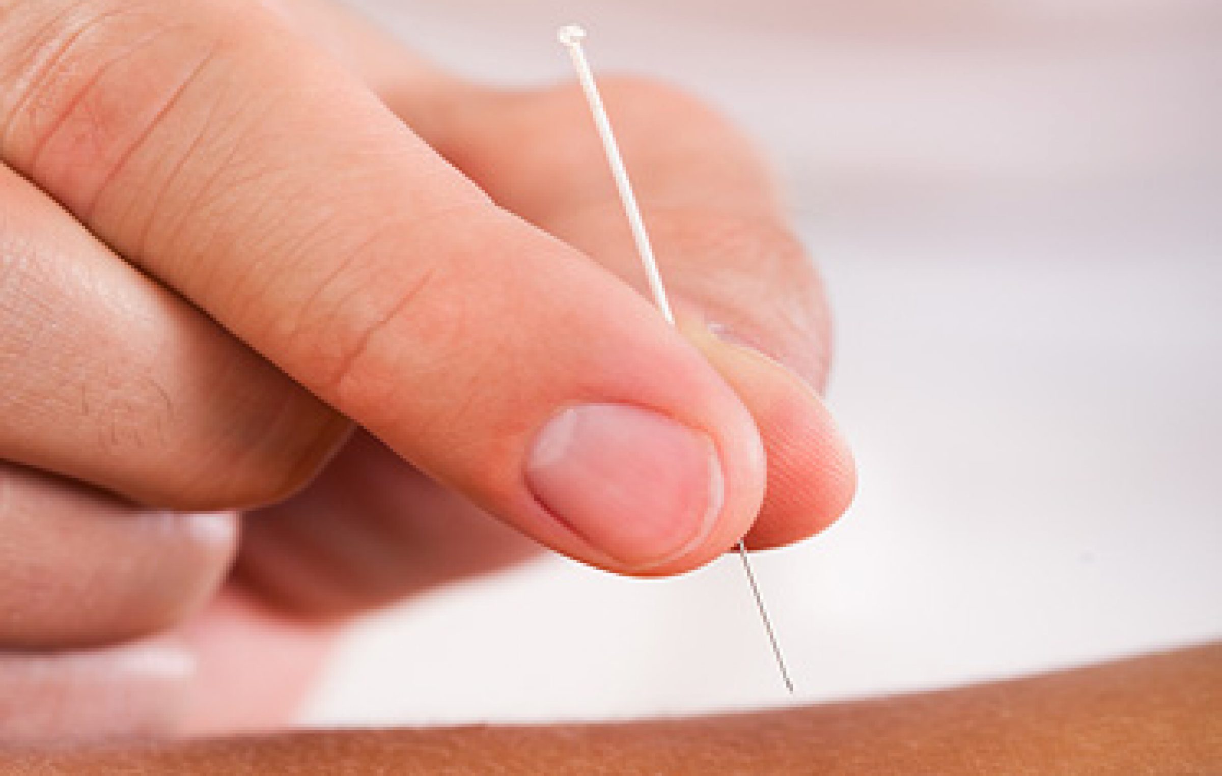 Acupuncture Helps Cancer Patients At Isabel Erdman Blog